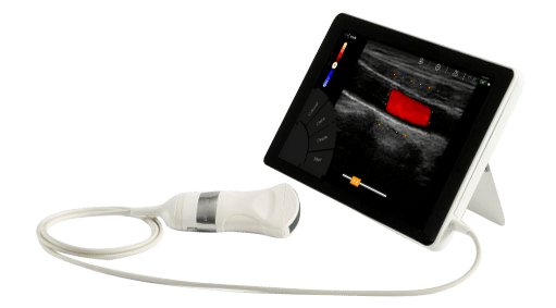 Echographe portable : une révolution en imagerie médicale